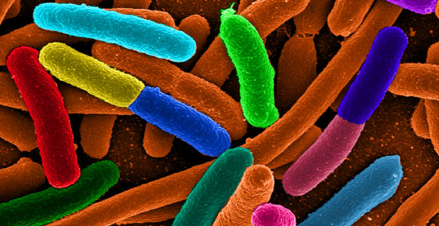 E. coli, one of the many species of bacteria present in the human gut (Mattosaurus)