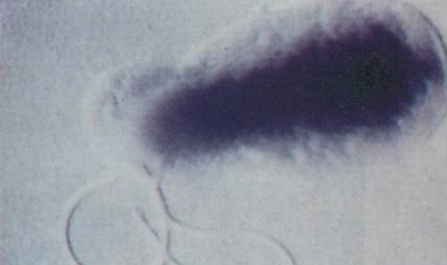 Bartonella bacterium (Ceshencam)