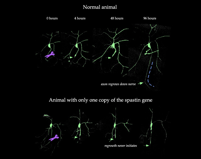 In fruit flies with two normal copies of the spastin gene, a team of scientists led by Prof Melissa Rolls of Penn State University found that severed axons were able to regenerate. However, in fruit flies with two or even only one abnormal spastin gene, the severed axons were not able to regenerate (Melissa Rolls / Penn State University)