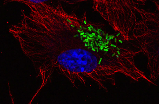 This image shows Salmonella bacteria, green, invading a human red blood cell (Kieran McGourty et al / Imperial College London)
