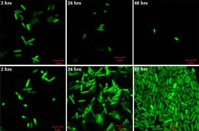 Biologists injected equal numbers of fluorescent E. coli bacteria into wild-type Drosophila embryos, upper images, and Jabba mutant Drosophila embryos lacking droplet-bound histones, and monitored the growth of bacteria inside them. Bacteria grow only in embryos lacking droplet-bound histones (Preetha Anand et al / eLife)