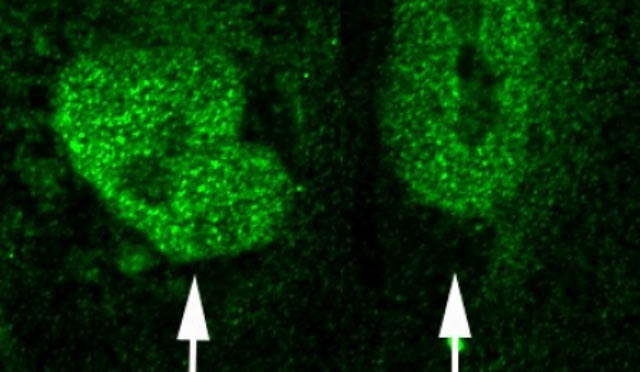Arrows point to cell nuclei in human embryonic stem cells in which a fibroblast growth factor receptor protein, FGFR1, targets diverse genes implicated in schizophrenia (M.K. Stachowiak / University at Buffalo)