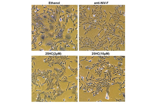 This light microscopy image shows vero cells transfected with Nipah virus F/G receptors, treated with ethanol, anti-NiV-F and 25HC, and fixed 21 hours after transfection (Su-Yang Liu et al)