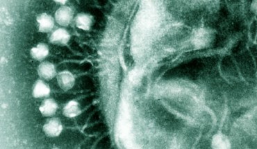 Electron micrograph of bacteriophages infecting a bacterial cell (Dr Graham Beards)