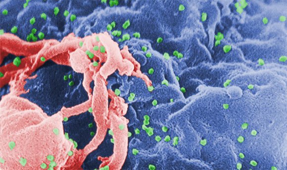 Scanning electron micrograph of HIV-1, shown in green, budding from cultured lymphocyte (C. Goldsmith) Scanning electron micrograph of HIV-1, shown in green, budding from cultured lymphocyte (C. Goldsmith)