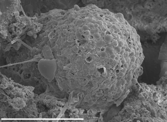This image shows a large and very complex, thick-walled, carbon-rich microfossil that the team has identified as a hystrichosphere. Scale bar - 100 μm (Jamie Wallis et al) This image shows a large and very complex, thick-walled, carbon-rich microfossil that the team has identified as a hystrichosphere. Scale bar - 100 μm (Jamie Wallis et al)