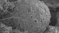 This image shows a large and very complex, thick-walled, carbon-rich microfossil that the team has identified as a hystrichosphere. Scale bar - 100 μm (Jamie Wallis et al)