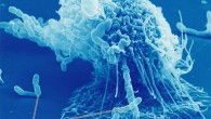 A macrophage engaging in phagocytosis of multiple bacteria (Midlands Technical College)
