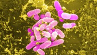 Pathogenic Escherichia coli attached to human cells in tissue culture (Donnenberg lab / U. Maryland at Baltimore)