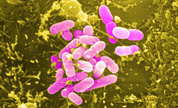Pathogenic Escherichia coli attached to human cells in tissue culture (Donnenberg lab / U. Maryland at Baltimore)