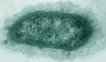 Methanobrevibacter smithii. This microorganism is responsible for the majority of methane production in the human host (Buck S. Samuel et al., 2007)