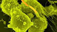 This scanning electron micrograph shows macrophages infected with Bacillus anthracis (Max Planck Institute for Infection Biology)