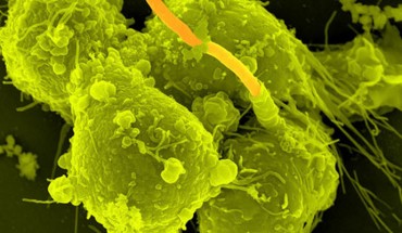 This scanning electron micrograph shows macrophages infected with Bacillus anthracis (Max Planck Institute for Infection Biology)