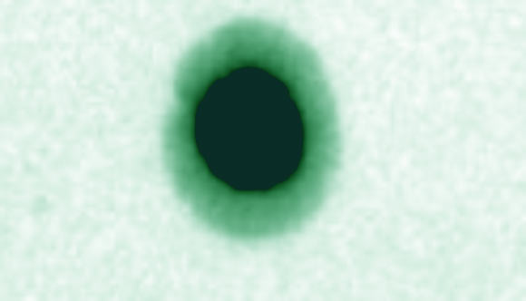 This false-color micrograph shows Clostridium bolteae (Brittany Pequegnat et al)