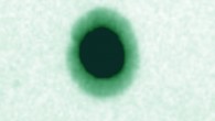 This false-color micrograph shows Clostridium bolteae (Brittany Pequegnat et al)