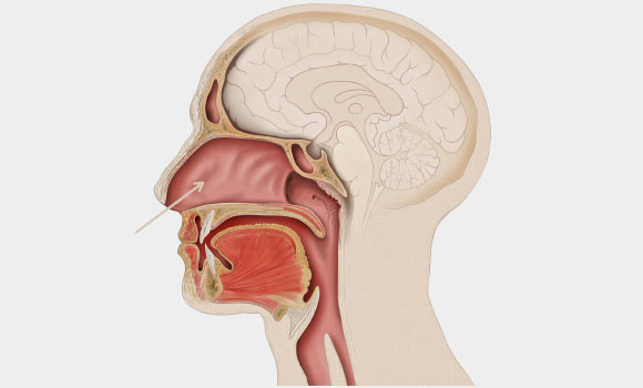 U.S.-Israeli team found that schizophrenia patients have elevated levels of a specific microRNA in the olfactory neuroepithelium (Patrick J. Lynch / CC BY 2.5)