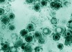 Micrograph of a herpes simplex virus (CDC / Dr Erskine Palmer)