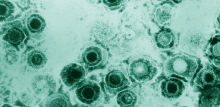 Micrograph of a herpes simplex virus (CDC / Dr Erskine Palmer)