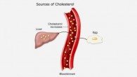 Sources of cholesterol (University of California, San Francisco)