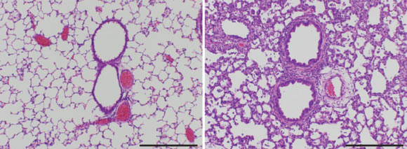 Eritoran treatment also improves lung pathology of H3N2 infection of cotton rats. Scale bars - 500 µm (Kari Ann Shirey et al)