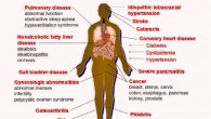 Scientists have identified three genetic variations - GALNT10, MIR148A-NFE2L3 and KLHL32 – associated with obesity in people of African ancestry