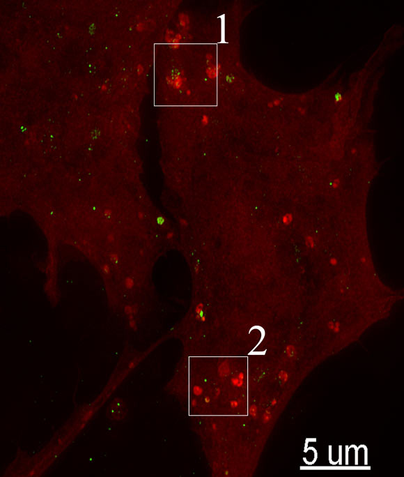 Structured illumination imaging of rat neuronal cells (Freeman D et al)