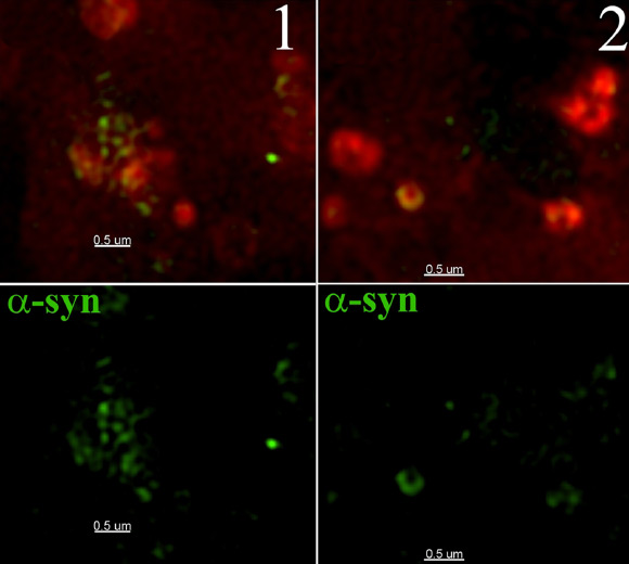 Structured illumination imaging reveals localization of alpha-synuclein in rat neuronal cells (Freeman D et al)