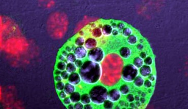 Newly identified type of brown adipocyte (University of Gothenburg)