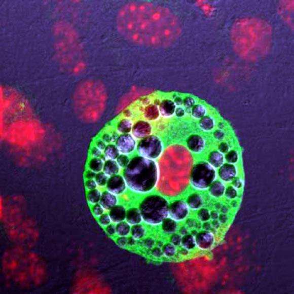 Newly identified type of brown adipocyte (University of Gothenburg)