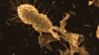 The image shows a healthy Streptococcus pneumoniae bacterial cell, upper left, next to a bacterial cell destroyed and lysed by the human milk protein complex HAMLET, lower right (Laura R. Marks)