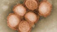 Micrograph shows H1N1 swine flu virus (C. S. Goldsmith / A. Balish, CDC)