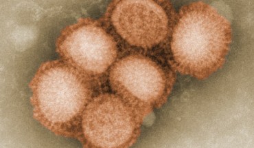 Micrograph shows H1N1 swine flu virus (C. S. Goldsmith / A. Balish, CDC)