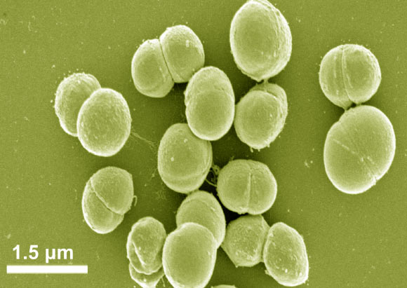 Planococcus halocryophilus OR1 (Nadia C S Mykytczuk et al, 2012)
