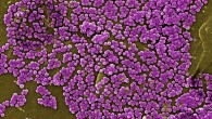 This micrograph shows methicillin-resistant Staphylococcus aureus (Janice Haney Carr / CDC / Jeff Hageman / M.H.S.)