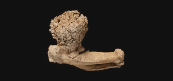 The 'musket ball' structure on a solitaire wing bone fossil (Julian P. Hume / Lorna Steel)