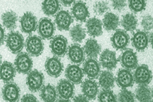 H9N2 virions are round or oval, with a diameter of 80 nm to 120 nm (Wenhua Kang et al, 2006 / Irish Veterinary Journal)