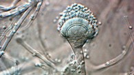 Aspergillus felis (Barrs VR et al)