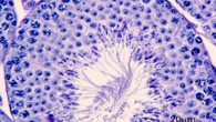PAS-stained paraffin section of testicular tubules from wild-type mice treated with clofibrate (Bedrich Mosinger et al)