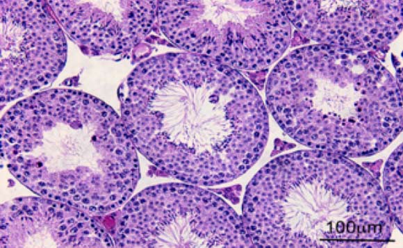 PAS-stained paraffin sections of testicular tubules from engineered mice with blocked TAS1R3 and GNAT3 (Bedrich Mosinger et al)