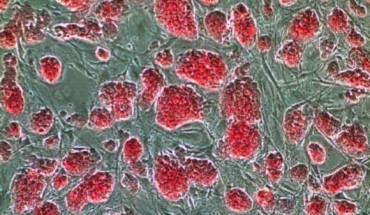 Colonies of the induced pluripotent stem cells (Boston University Center for Regenerative Medicine)