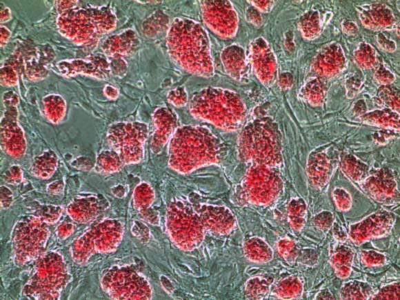 Colonies of the induced pluripotent stem cells (Boston University Center for Regenerative Medicine)