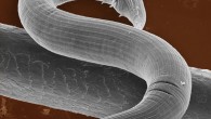 The nematode Pristionchus maxplancki can change the shape of its mouth depending on the form of its nourishment (MPI for Developmental Biology)