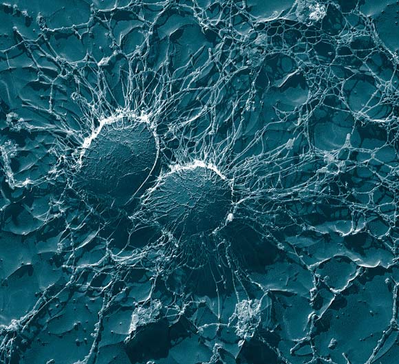 Bacterial cells of Staphylococcus aureus (Eric Erbe, Christopher Pooley)