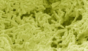 This SEM image shows chronic Salmonella Typhi biofilm formation on cholesterol gallstones (Robert Crawford et al, 2010)