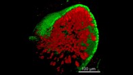 This is a 3D reconstruction of the stem-cell-derived otic vesicle (Karl Koehler et al)