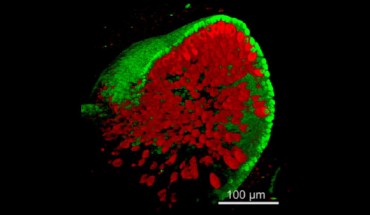 This is a 3D reconstruction of the stem-cell-derived otic vesicle (Karl Koehler et al)