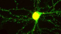 This image shows a living neuron in culture: green dots indicate excitatory synapses; red dots indicate inhibitory synapses (Don Arnold)