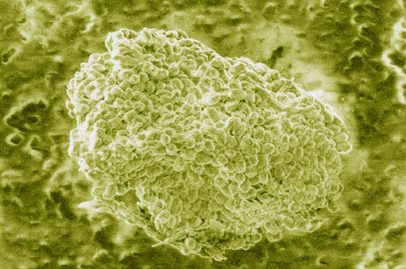 Bacillus anthracis spores as viewed in scanning electron microscopy (© National Academy of Engineering)
