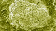 Bacillus anthracis spores as viewed in scanning electron microscopy (© National Academy of Engineering)