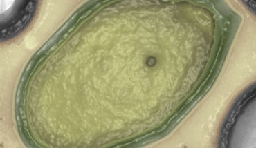 Pandoravirus salinus (© IGS CNRS-AMU)